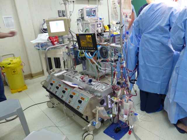 the perfusion machine