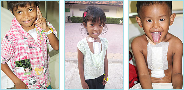 Cambodian children heart patients